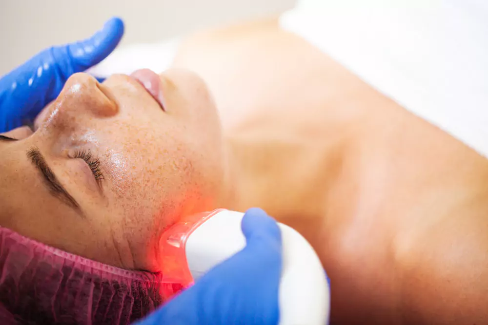 Laser Treatment